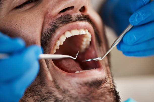 Best Walk-In Emergency Dentist in Forest Heights, MD