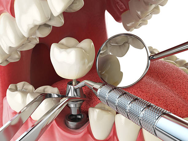 Best Emergency Tooth Extraction in Forest Heights, MD